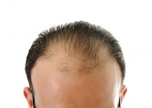 Hair Loss Geeks
